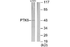 Western blot analysis of extracts from LOVO cells, using Breast Tumor Kinase antibody. (PTK6 antibody)