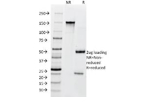 SDS-PAGE Analysis Purified BCL10 Mouse Monoclonal Antibody (SPM520).