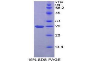 SDS-PAGE analysis of Mouse PICK1 Protein. (PICK1 Protein)