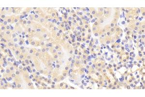 Detection of MMP1 in Mouse Kidney Tissue using Polyclonal Antibody to Matrix Metalloproteinase 1 (MMP1) (MMP1 antibody  (AA 98-275))