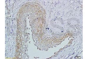 Formalin-fixed and paraffin embedded rat ovary tissue labeled with (ABIN729508) Rabbit Anti-FSH receptor Polyclonal Antibody, Unconjugated1:200 followed by conjugation to the secondary antibody and DAB staining. (FSHR antibody  (AA 201-300))