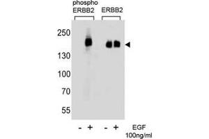 Western blot analysis of extracts from A431 cells, untreated or treated with EGF (100ng/ml), using phos-ERBB2 antibody (left) or nonphos Ab (right) (ErbB2/Her2 antibody  (pTyr1127))