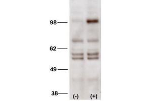 Western Blotting (WB) image for anti-Phosphoinositide-3-Kinase, Class 3 (PIK3C3) antibody (ABIN3000296) (PIK3C3 antibody)