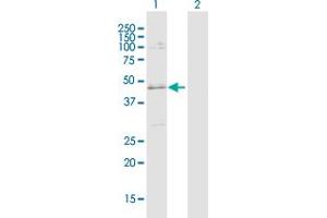 Western Blot analysis of SLC25A31 expression in transfected 293T cell line by SLC25A31 MaxPab polyclonal antibody. (SLC25A31 antibody  (AA 1-315))