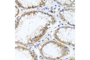 Immunohistochemistry of paraffin-embedded human stomach using GPM6A antibody at dilution of 1:100 (x40 lens). (GPM6A antibody)