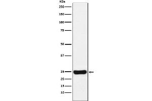 Western blot analysis of Cathepsin S expression in U87-MG cell lysate.