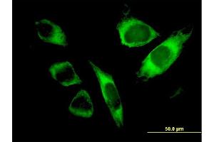 Immunofluorescence of monoclonal antibody to SPATA2 on HeLa cell. (SPATA2 antibody  (AA 422-519))
