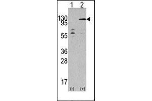 Western blot analysis of TAOK3 (arrow) using rabbit polyclonal TAOK3 Antibody (TAO Kinase 3 antibody  (C-Term))