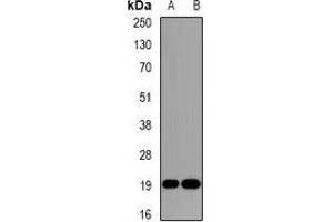 Western blot analysis of DR1 expression in Jurkat (A), HepG2 (B) whole cell lysates. (DR1 antibody)