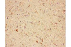 IHC-P: CNTF antibody testing of rat brain tissue