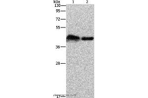 Western blot analysis of Mouse bladder tissue and 293T cell, using CRELD1 Polyclonal Antibody at dilution of 1:930 (CRELD1 antibody)