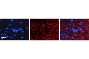 RGS6 antibody - C-terminal region          Formalin Fixed Paraffin Embedded Tissue:  Human Pineal Tissue    Observed Staining:  Cytoplasm and Membrane of Human Pineal Tissue   Primary Antibody Concentration:  1:100    Other Working Concentrations:  1/600    Secondary Antibody:  Donkey anti-Rabbit-Cy3    Secondary Antibody Concentration:  1:200    Magnification:  20X    Exposure Time:  0. (RGS6 antibody  (C-Term))