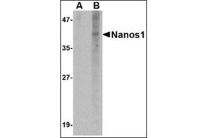 Western blot analysis of Nanos1 in SK-N-SH cell lysate with this product at 1 μg/ml in (A) the presence and (B) the absence of blocking peptide. (Nanos Homolog 1 antibody  (N-Term))
