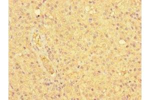 Immunohistochemistry of paraffin-embedded human adrenal gland tissue using ABIN7157661 at dilution of 1:100 (NDC8 (AA 1-249) antibody)