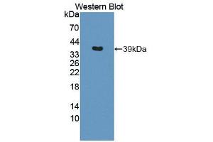 Western blot analysis of the recombinant protein. (IL12B antibody  (AA 23-329))