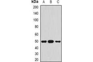 Western blot analysis of Serpin A4 expression in HepG2 (A), mouse pancreas (B), rat pancreas (C) whole cell lysates. (SERPINA4 antibody)