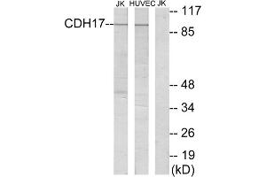 Western blot analysis of extracts from Jurkat cells and HUVEC cells, using CDH17 antibody. (LI Cadherin antibody  (Internal Region))