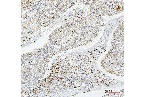 IHC analysis of CD43 using anti-CD43 antibody (ABIN7601042). (CD43 antibody  (AA 272-400))