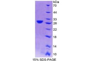 Image no. 1 for phosphofructokinase, Platelet (PFKP) (AA 247-473) protein (His tag) (ABIN6237937)