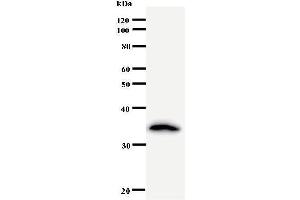 Western Blotting (WB) image for anti-Crooked Neck Pre-mRNA Splicing Factor-Like 1 (CRNKL1) antibody (ABIN931026) (CRNKL1 antibody)