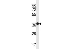 MUC15 antibody western blot analysis in WiDr lysate. (MUC15 antibody  (AA 209-237))