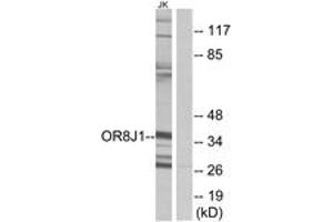 Western blot analysis of extracts from Jurkat cells, using OR8J1 Antibody. (OR8J1 antibody  (AA 233-282))