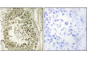 Immunohistochemistry analysis of paraffin-embedded human testis tissue using HGS antibody. (HGS antibody)