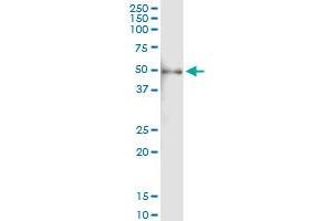 Immunoprecipitation of PHGDH transfected lysate using anti-PHGDH MaxPab rabbit polyclonal antibody and Protein A Magnetic Bead , and immunoblotted with PHGDH purified MaxPab mouse polyclonal antibody (B01P) . (PHGDH antibody  (AA 1-533))