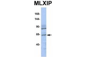 Western Blotting (WB) image for anti-MLX Interacting Protein (MLXIP) (Middle Region) antibody (ABIN2776519)