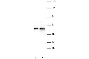 DMAP1 antibody (pAb) tested by Western blot. (DMAP1 antibody  (C-Term))