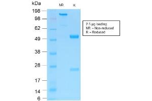 SDS-PAGE Analysis of Purified NGFR Rabbit Recombinant Monoclonal Antibody ABIN6383799. (Recombinant NGFR antibody)