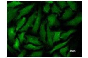 Immunostaining analysis in HeLa cells. (Transportin 3 antibody)