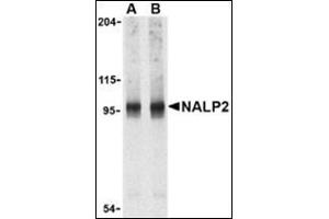 Western blot analysis of NALP2 in PC-3 cell lysate with this product at (A) 1 and (B) 2 μg/ml. (NLRP2 antibody  (C-Term))