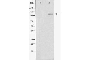 Western blot analysis of Hela whole cell lysates, using ABL1 Antibody. (ABL1 antibody  (N-Term))