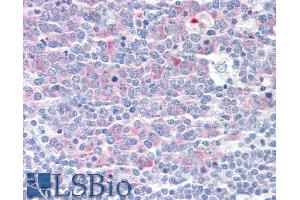 ABIN570990 (5µg/ml) staining of paraffin embedded Human Tonsil.
