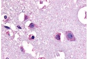 Anti-CRF1 antibody  ABIN1048460 IHC staining of human human brain, neurons and glia. (CRHR1 antibody  (N-Term))