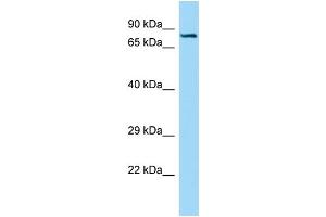 WB Suggested Anti-SEMA7A Antibody Titration: 1. (SEMA7A antibody  (C-Term))