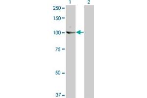 Western Blot analysis of KIT expression in transfected 293T cell line by KIT monoclonal antibody (M02), clone 6F2. (KIT antibody  (AA 41-140))