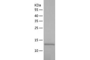 Western Blotting (WB) image for RAB Interacting Factor (RABIF) (AA 1-123) protein (His tag) (ABIN7286218) (RABIF Protein (AA 1-123) (His tag))