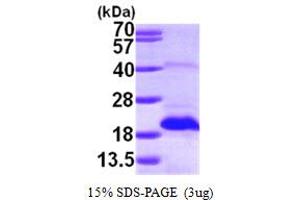 MSRB2 Protein (AA 21-182) (His tag)