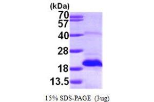 SDS-PAGE (SDS) image for Methionine Sulfoxide Reductase B2 (MSRB2) (AA 21-182) protein (His tag) (ABIN667287)