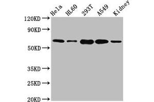 Western Blot Positive WB detected in: Hela whole cell lysate, HL60 whole cell lysate, 293T whole cell lysate, A549 whole cell lysate, Mouse kidney tissue All lanes: SLAMF6 antibody at 5.