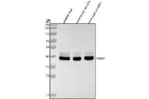 Western blot analysis of MYOD1 using anti-MYOD1 antibody (A).