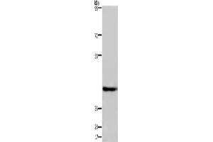 Western Blotting (WB) image for anti-Developmentally Regulated GTP Binding Protein 1 (DRG1) antibody (ABIN2429959)