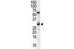The DSCR1 antibody used in western blot to detect DSCR1 in endothelial tissue lysate (RCAN1 antibody  (AA 222-252))