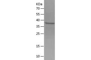 Western Blotting (WB) image for CD99 (CD99) (AA 25-122) protein (His-IF2DI Tag) (ABIN7283762) (CD99 Protein (CD99) (AA 25-122) (His-IF2DI Tag))