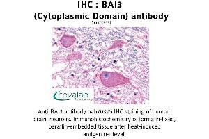 Image no. 1 for anti-Brain-Specific Angiogenesis Inhibitor 3 (BAI3) (3rd Cytoplasmic Domain) antibody (ABIN1732207) (BAI3 antibody  (3rd Cytoplasmic Domain))