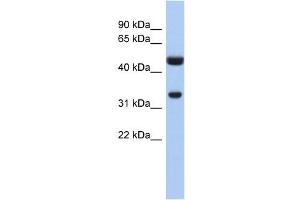 SULT1B1 antibody used at 1 ug/ml to detect target protein.