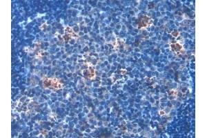 Detection of HSD17b12 in Mouse Lymph node Tissue using Polyclonal Antibody to 17-Beta-Hydroxysteroid Dehydrogenase Type 12 (HSD17b12) (HSD17B12 antibody  (AA 1-312))