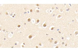 Detection of APPBP1 in Human Cerebrum Tissue using Polyclonal Antibody to Amyloid Beta Precursor Protein Binding Protein 1 (APPBP1) (NAE1 antibody  (AA 229-534))